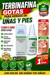 TERBINAFINA GOTAS PARA HONGOS EN LAS UÑAS y PIES
