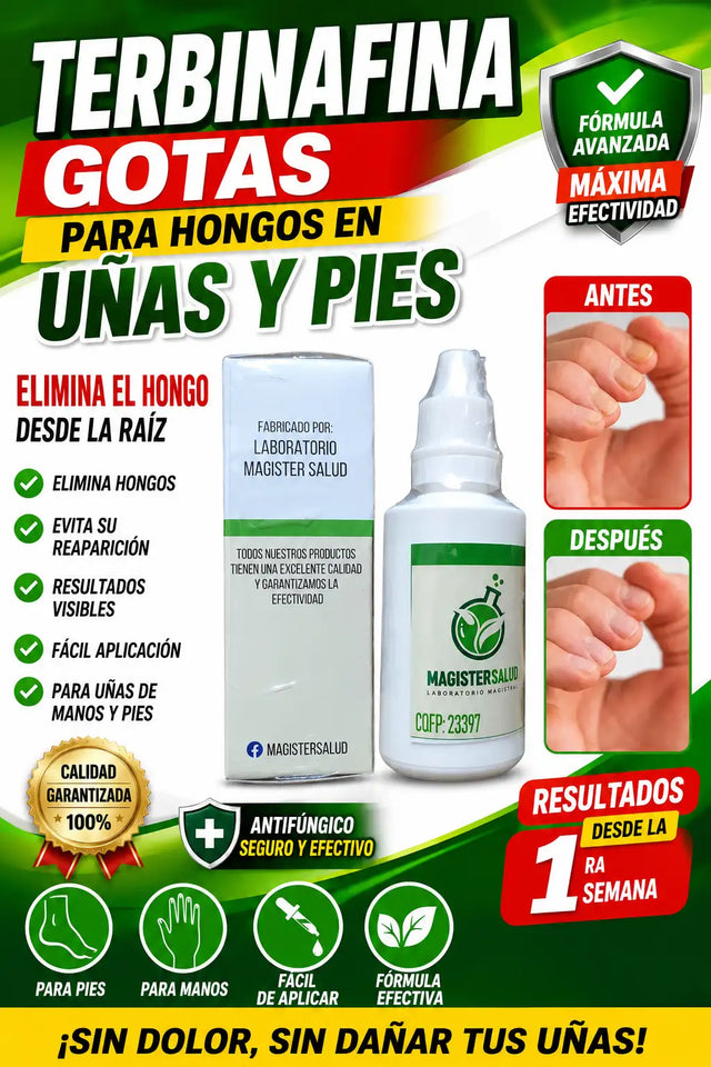 TERBINAFINA GOTAS PARA HONGOS EN LAS UÑAS y PIES